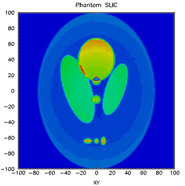 Shepp-Logan ideal collimator preview