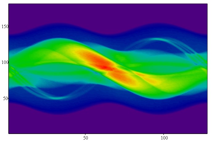 Shepp-Logan ideal collimator sinogram preview