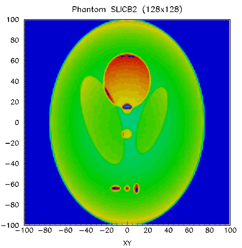 Shepp-Logan ideal collimator 2x high background preview